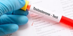 signes baisse de testostérone